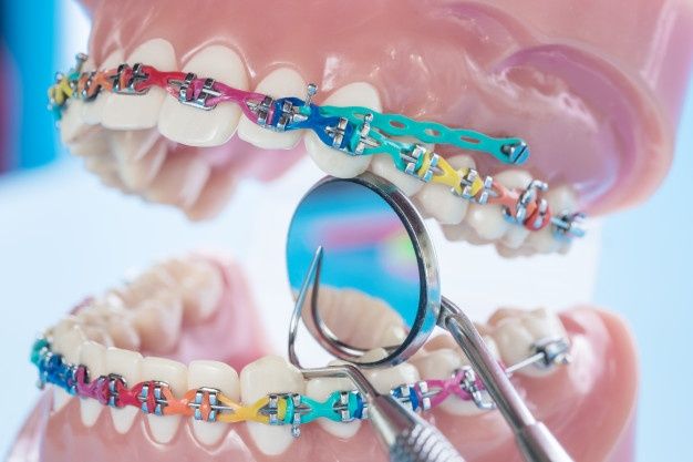 Premium Photo _ Orthodontic model and dentist tool…
